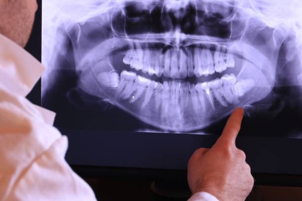 Best Emergency Gum Treatment in Roseland, NJ