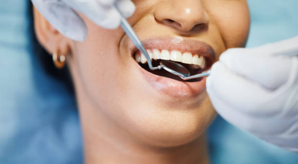 Best Emergency Dental Care for Broken or Chipped Teeth in Roseland, NJ